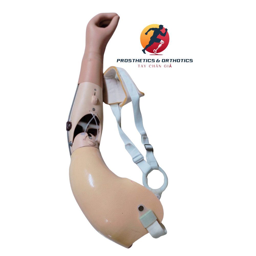 Tay giả cơ học trên khuỷu