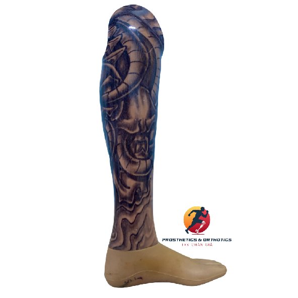 Chân dưới gối - Ốp thẩm mỹ cứng