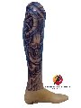 Chân dưới gối - Ốp thẩm mỹ cứng