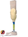 Chân Dưới Gối - Vớ Silicon + Bàn Khớp Mắt Cá