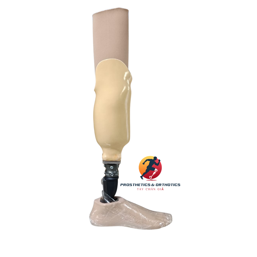 Chân giả dưới gối silicon + Bàn carbon cổ cao