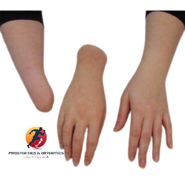 Găng tay thẩm mỹ - Làm theo khuôn