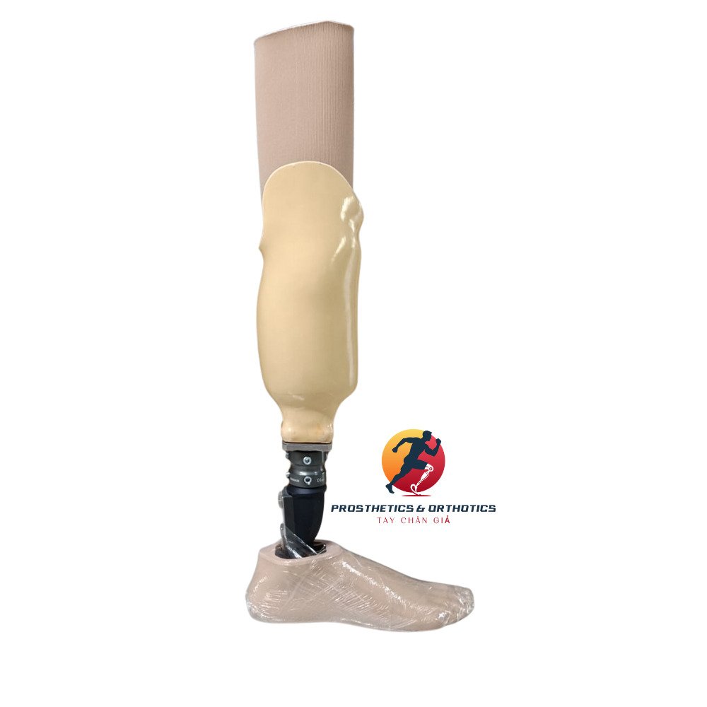 Chân giả dưới gối silicon + Bàn carbon cổ cao