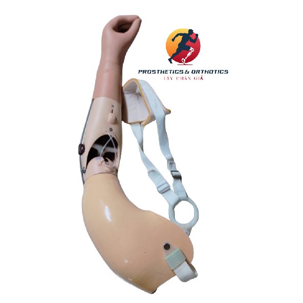 Tay giả cơ học trên khuỷu