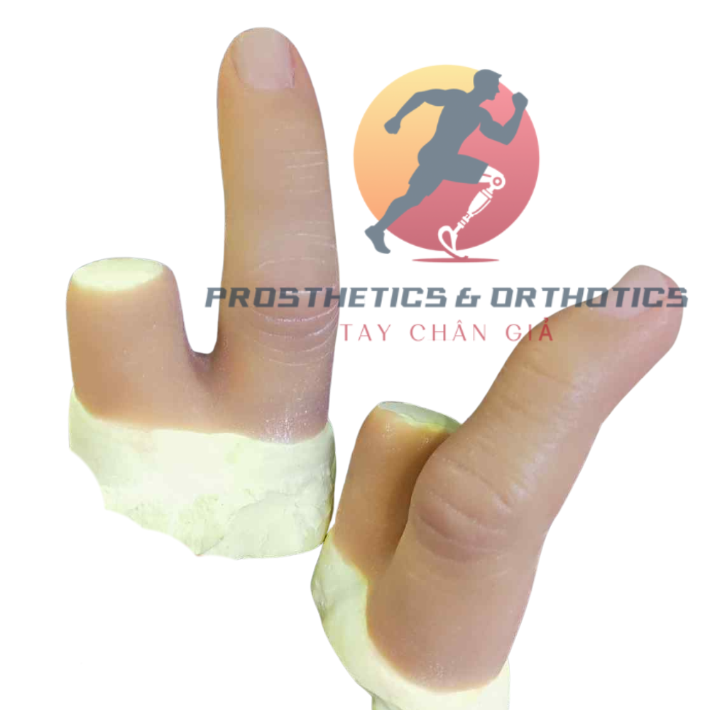 Ngón tay thẩm mỹ - Thường