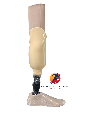 Chân giả dưới gối silicon + Bàn carbon cổ cao
