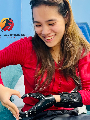 Tay Cơ - Mất một phần bàn tay